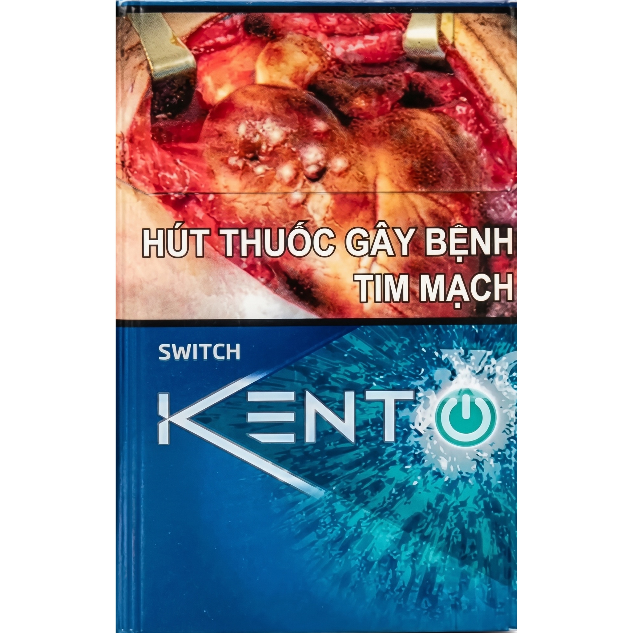 Kent Switch