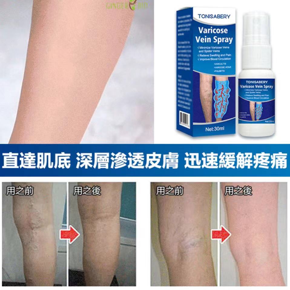 TONISABERY英國靜脈按摩曲張噴劑