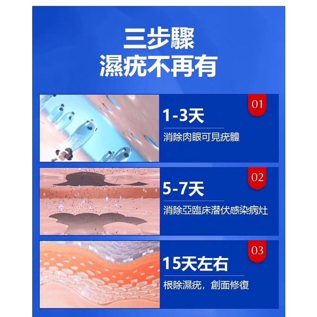 超夯祛疣膏，一抹就祛疣，無需激光手術，輕鬆祛除，安全有效！