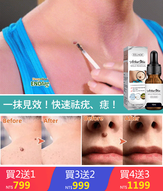 祛痣克疣精華液