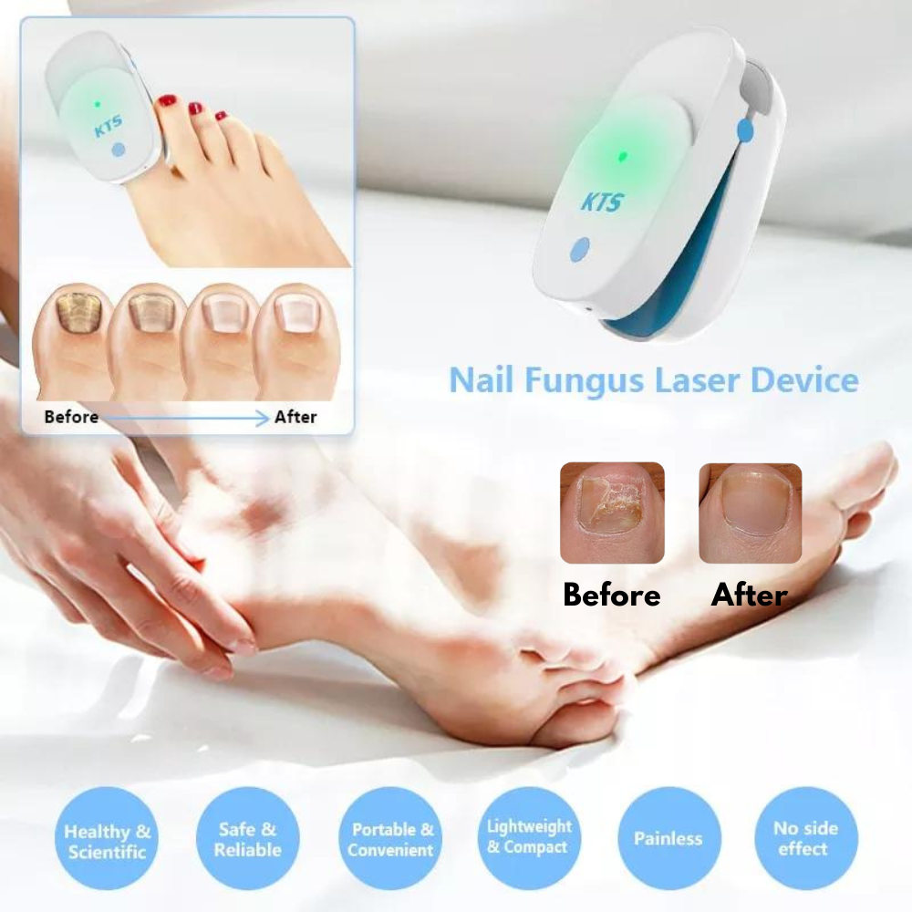 Fungal Nail Treatment Laser Device For Nail Fungus 905nm 470nm Fungus ...