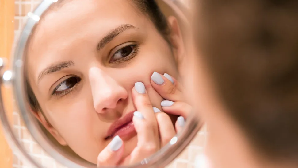 10 Best Ingredients for Acne-Prone Skin in Skincare and Makeup Products-HAUS