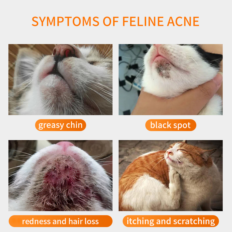 Oily Skin Cleaning Chin Cleanser