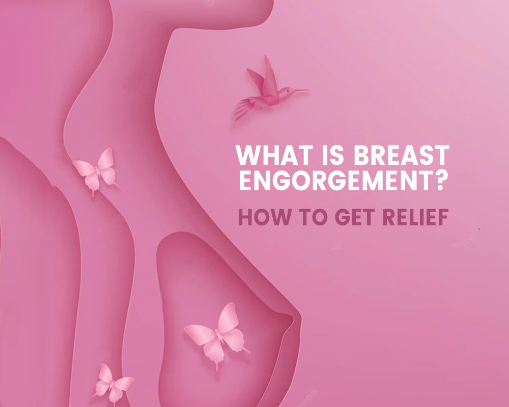 What is breast engorgement ? How to get relief?