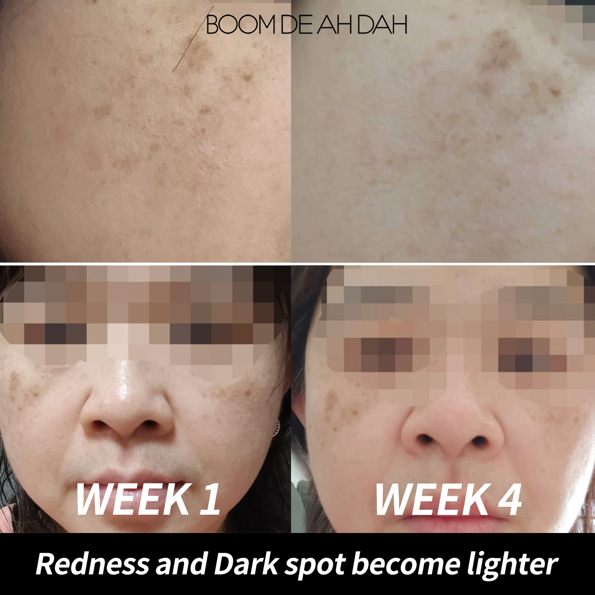 10% Niacinamide Ampoule 50ml