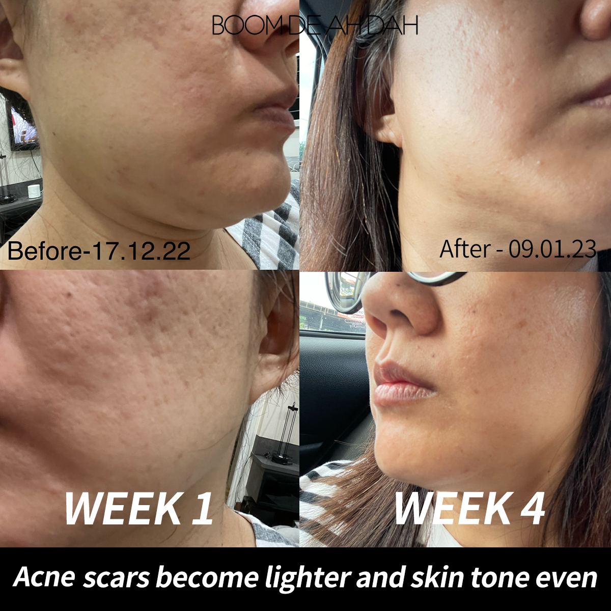 10% Niacinamide Ampoule 50ml