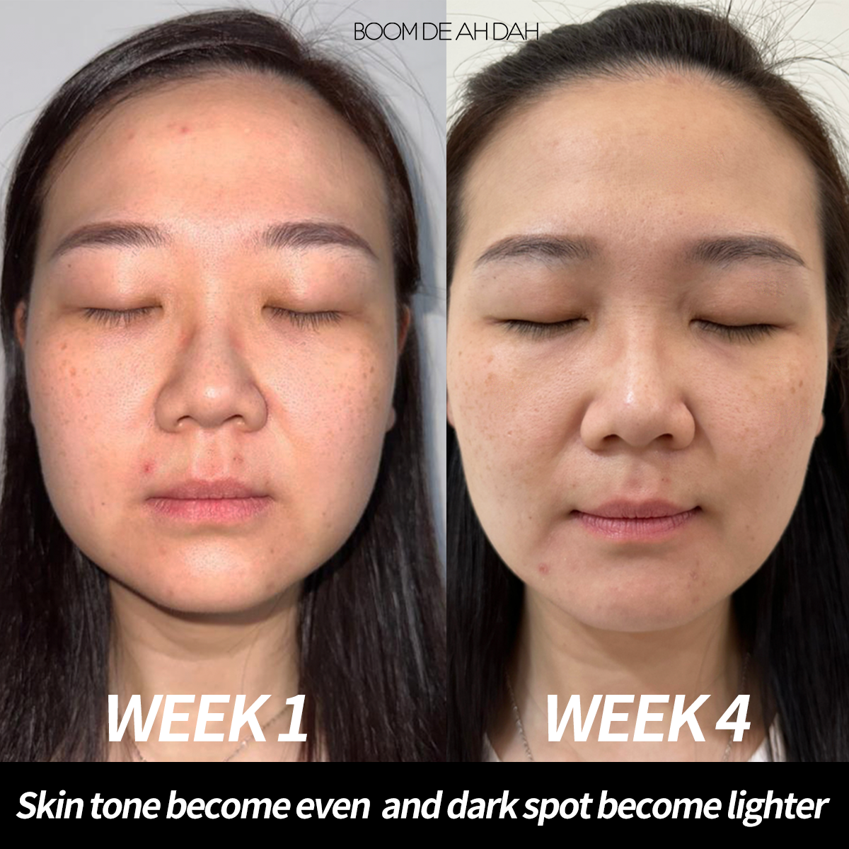 Boom De Ah Dah Niacinamide Ampoule | 30 Days Skin Glowing Journey