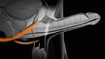 1666153594559647.gif 1659521254567175.gif