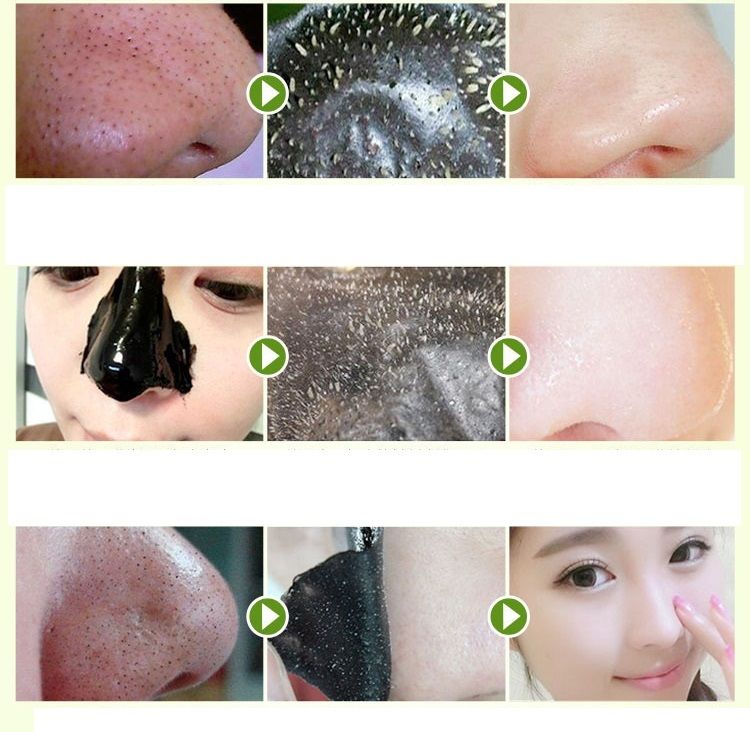 20 X PILATEN BLACKHEAD REMOVER Face Nose Skin Acne Mud Mask Pore