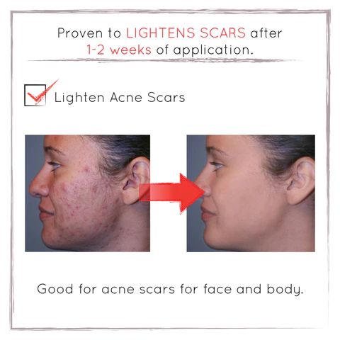 Lasertox CC Miracle White Lotion SPF30 PA++ (Multifunctional CC Sunscreen Lotion)